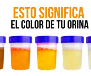 El Color de tu Orina Puede Revelar tu Estado de Salud, Conócelo