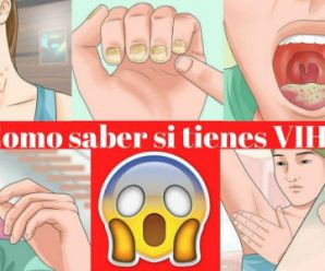 Podrás tener VIH SIDA sin Saberlo, Éstos son los Síntomas Más Frecuentes